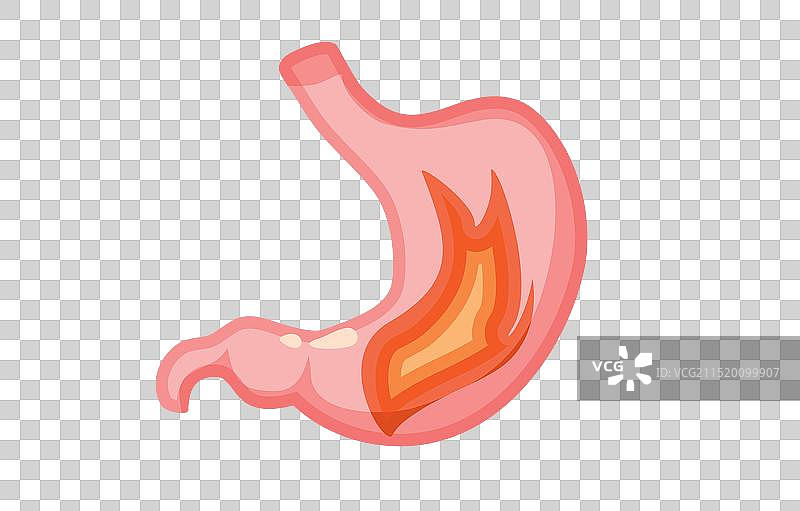 胃部着火卡通人物感到疼痛图片素材
