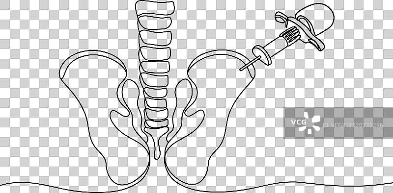 骨髓穿刺术单线图图片素材