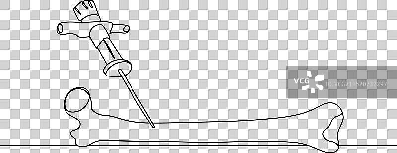 股骨穿刺单线图图片素材