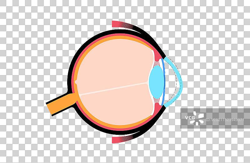 白内障眼病图片素材