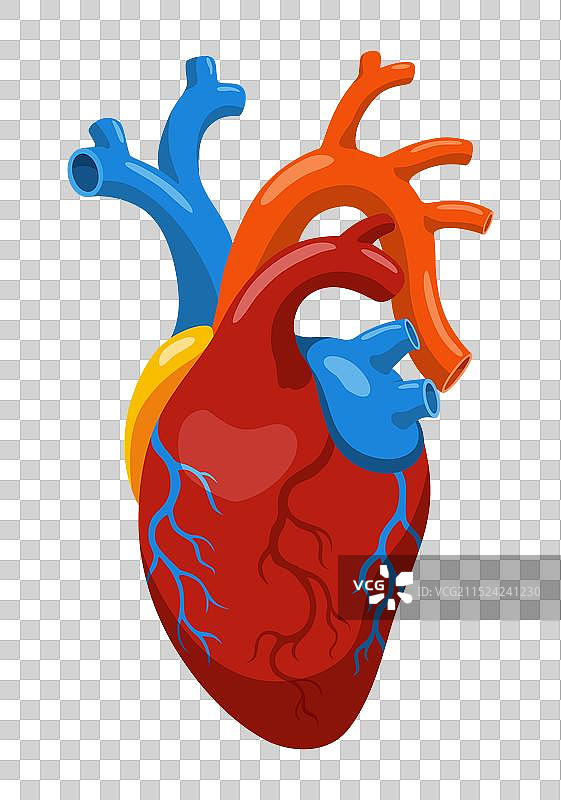 动脉粥样硬化心脏病发作解剖图图片素材