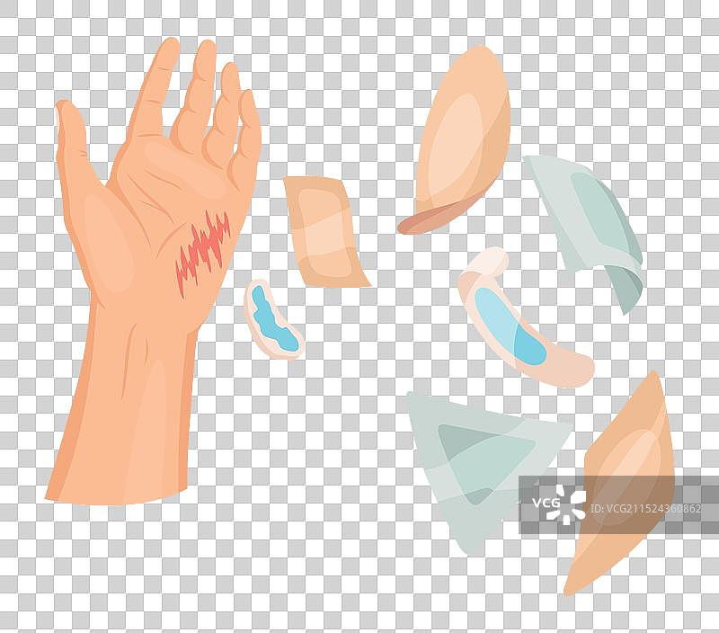 手部皮肤损伤与包扎图片素材