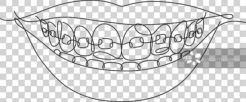 牙套微笑扁平线条白色图片素材
