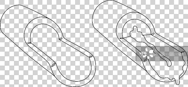 囊性纤维化气道单线图图片素材