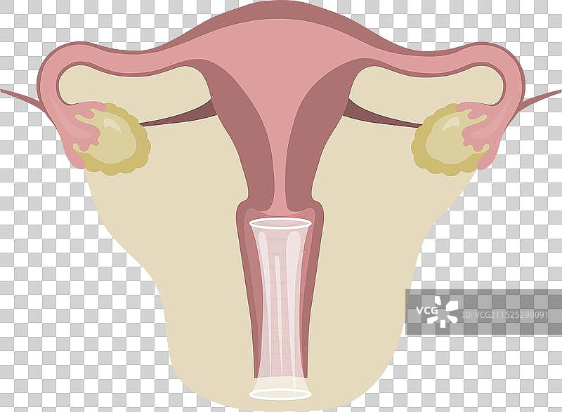 女用避孕套图片素材