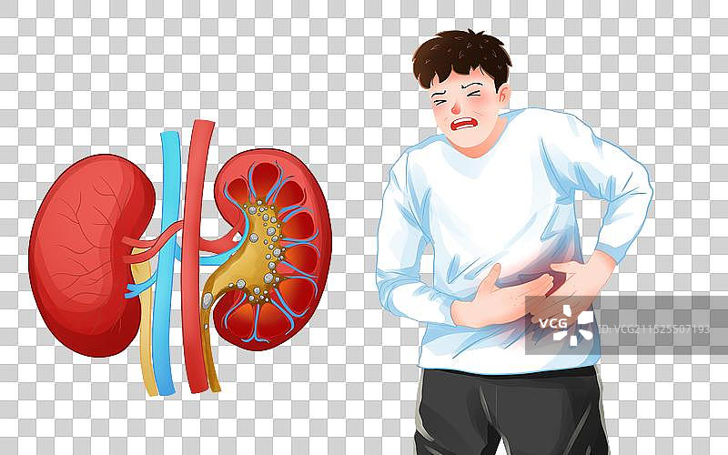 医疗健康肾结石肚子疼的男人插画图片素材