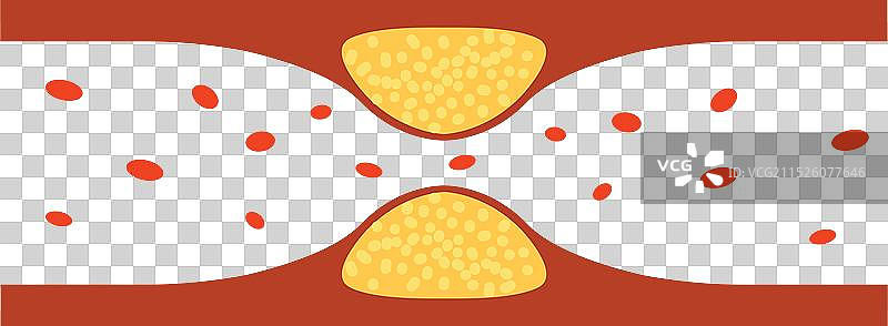 胆固醇血栓微血管图标图片素材