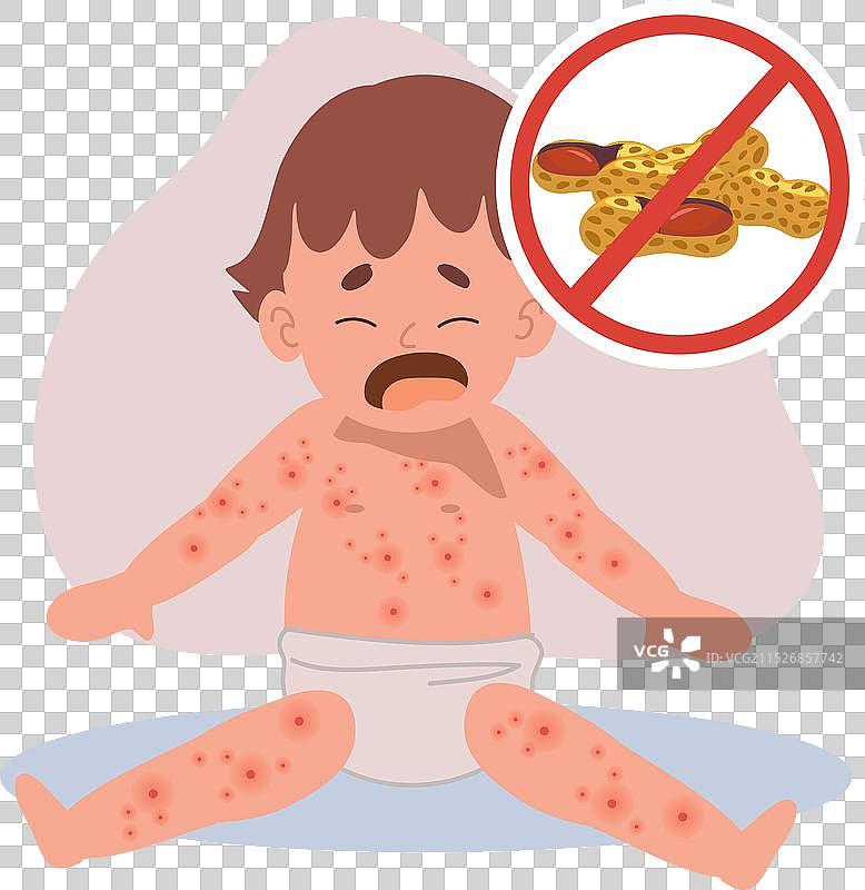 婴儿过敏反应与皮疹图片素材