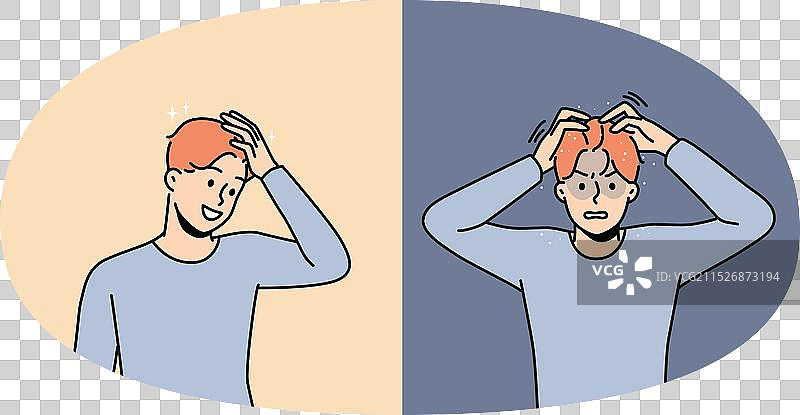 去屑治疗前后对比：年轻男子图片素材