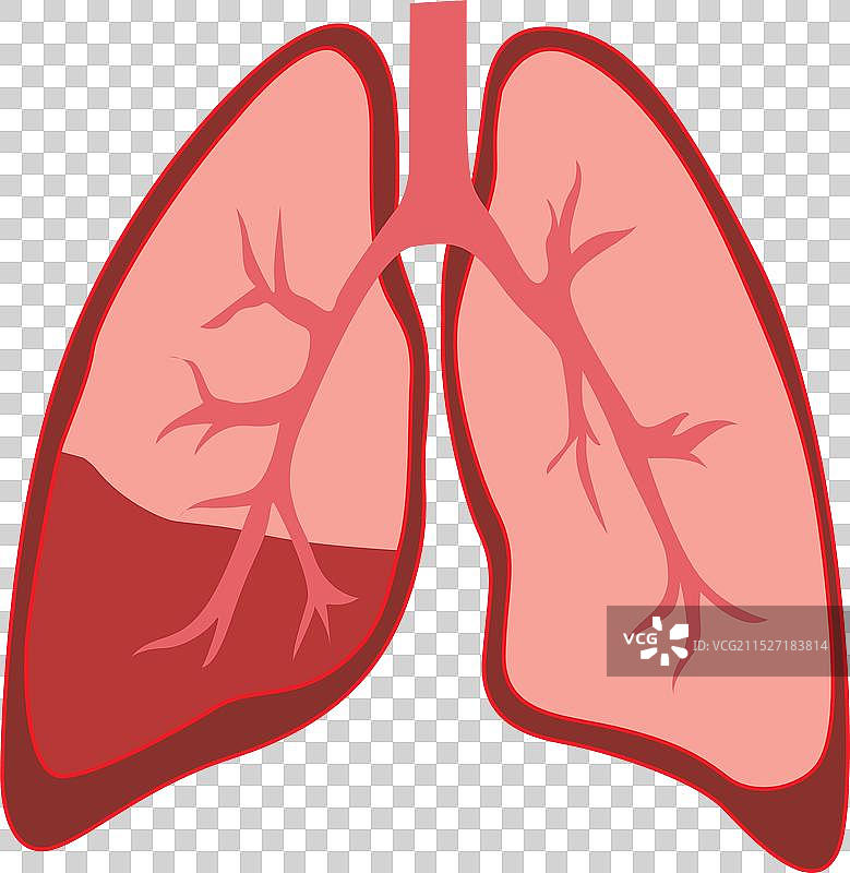 护理用人体肺部解剖图图片素材