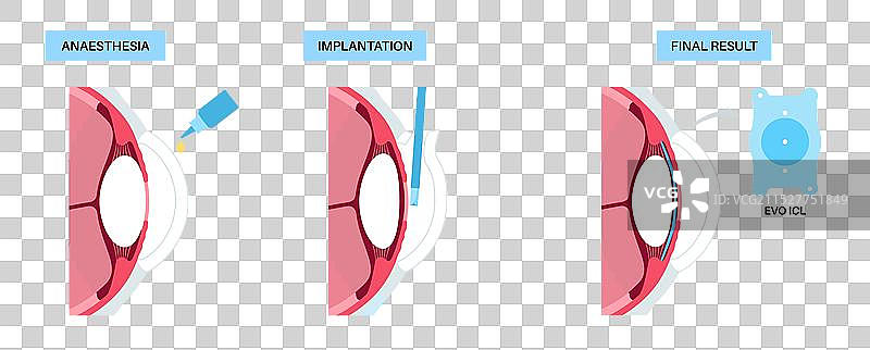 evo icl 海报图片素材