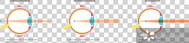 远视和近视图片素材