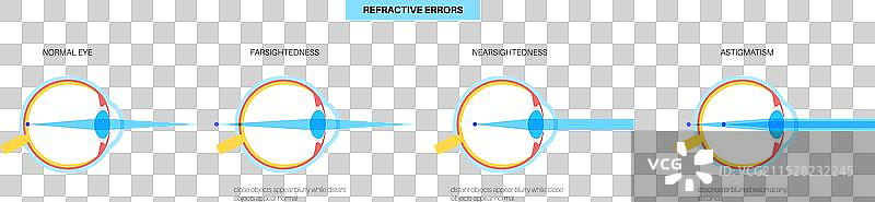 屈光不正海报图片素材