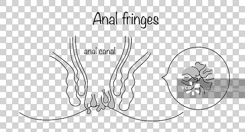 肛门边缘图片素材