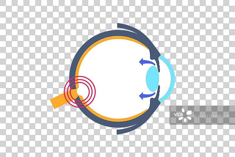 青光眼眼压图片素材