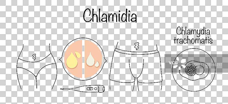 衣原体感染图片素材