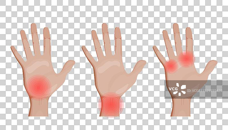 手腕和关节疼痛图片素材