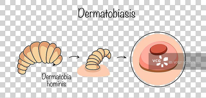 皮肤虫病图片素材