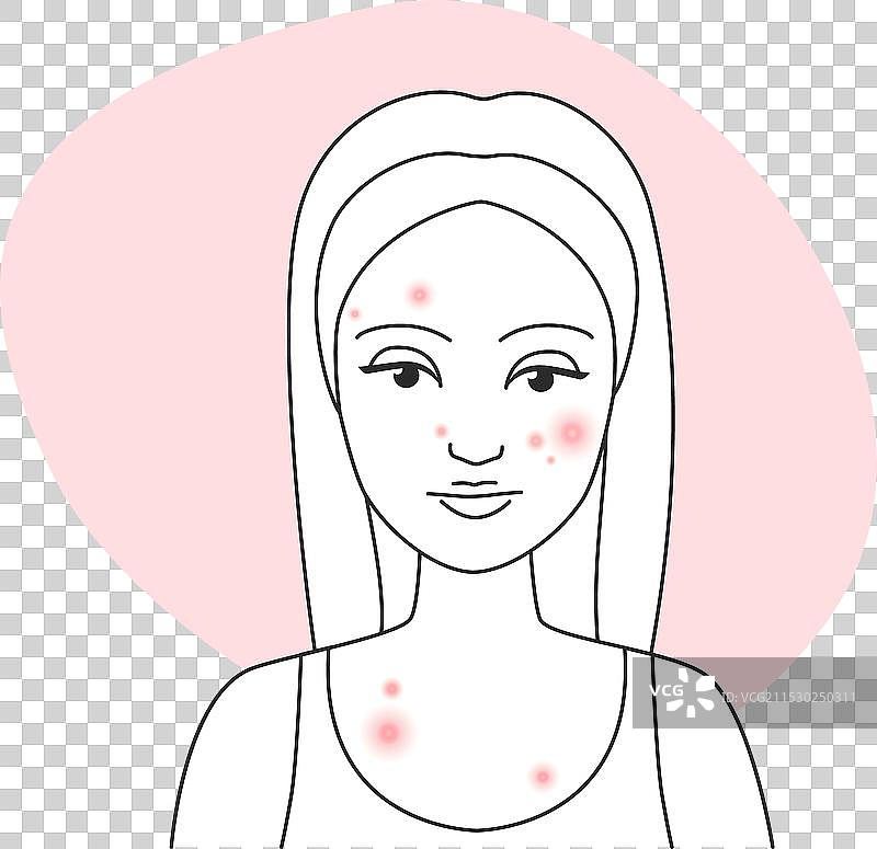 面部有痘痘的年轻女性显得很伤心图片素材