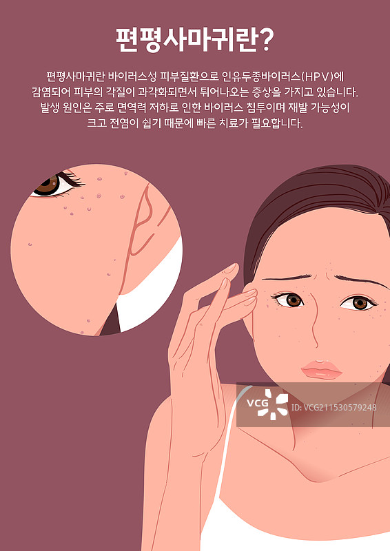 女性，护肤，疣图片素材