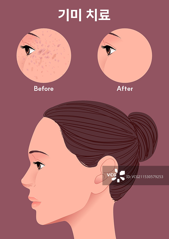 女性，护肤，雀斑图片素材