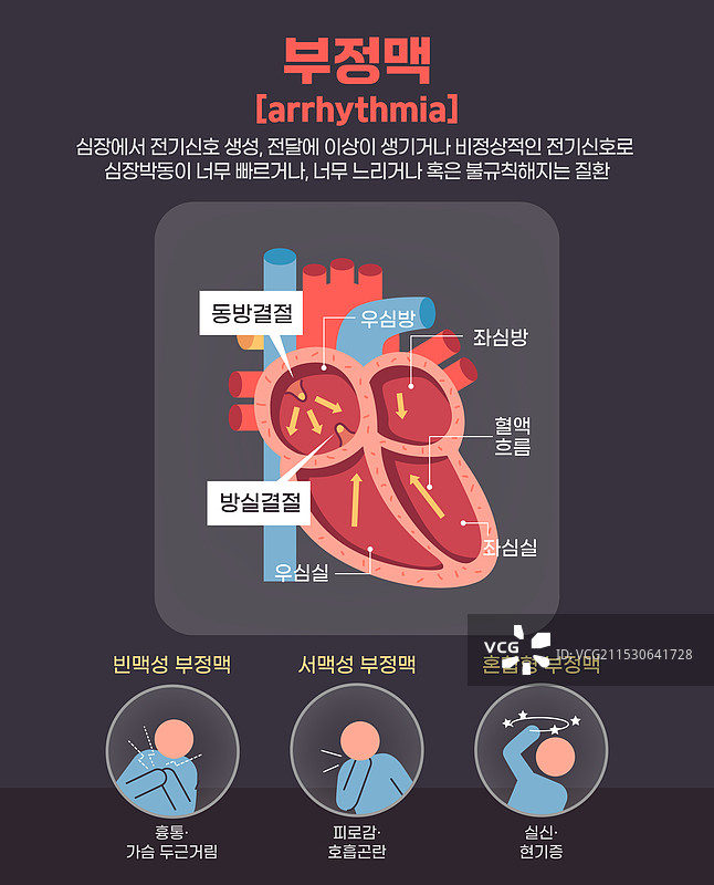 心脏，疾病，医疗保健，心律失常图片素材