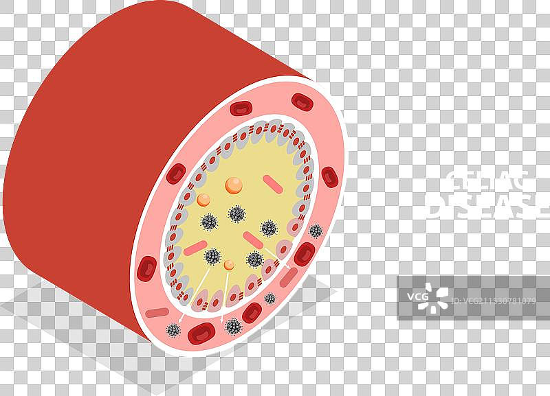 腹腔的三维等距平面图图片素材