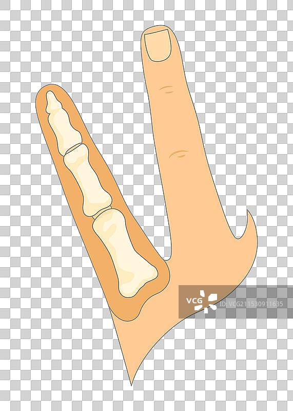 骨骼类型的教育解剖学骷髅图片素材