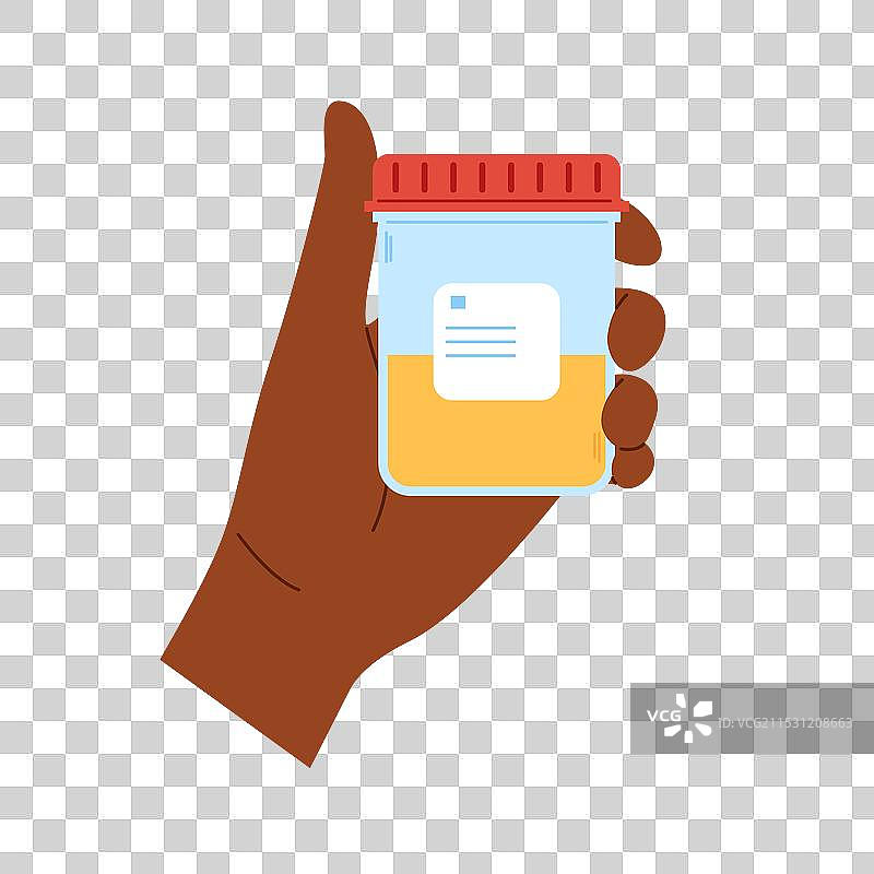 非洲人的手握着装有尿液样本的容器图片素材