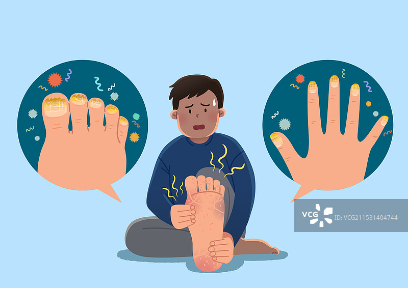 疾病，脚气，病毒，指甲，趾甲，人类脚部图片素材