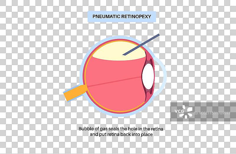 气压视网膜复位海报图片素材