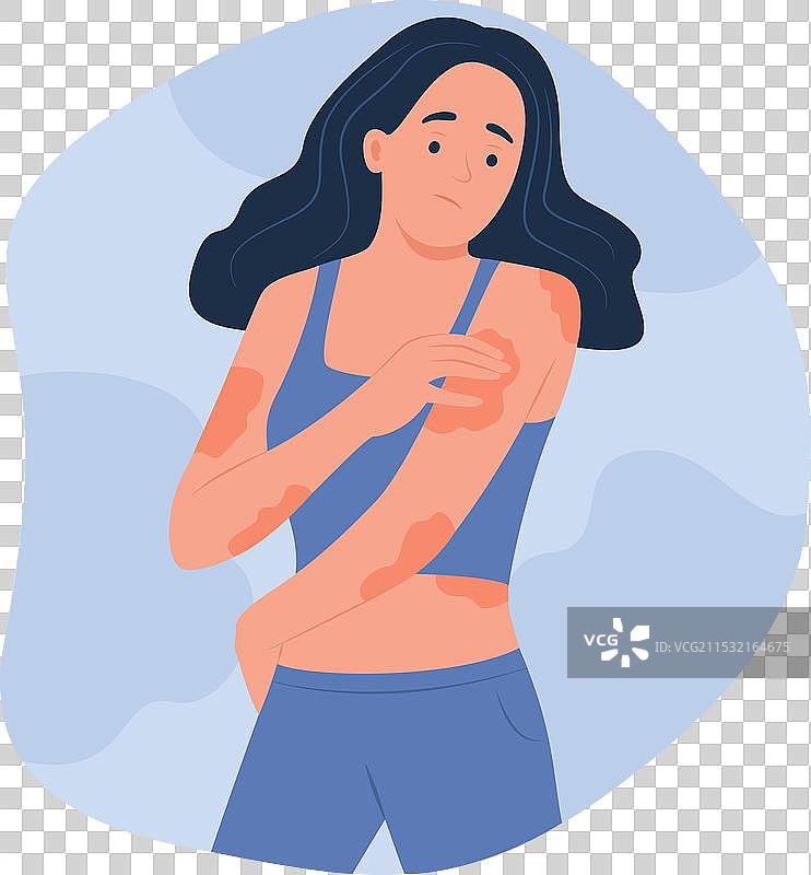 女性查看身体上的湿疹图片素材