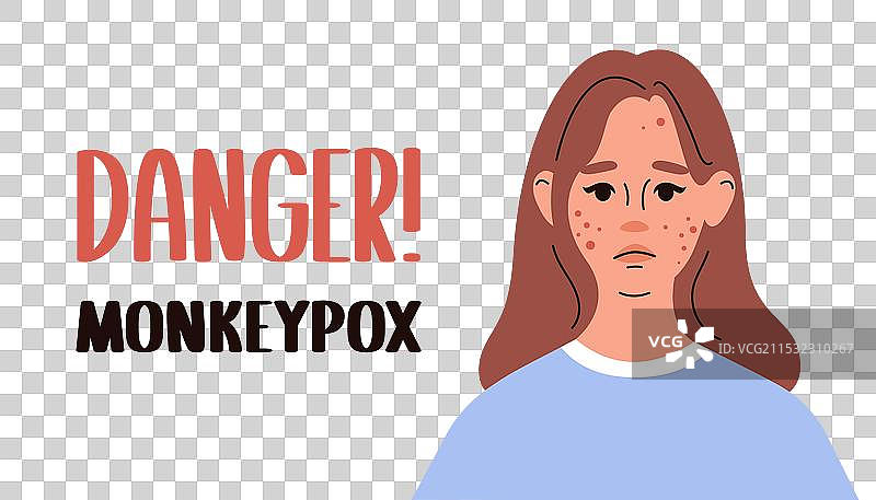 猴痘感染女性的网页横幅图片素材