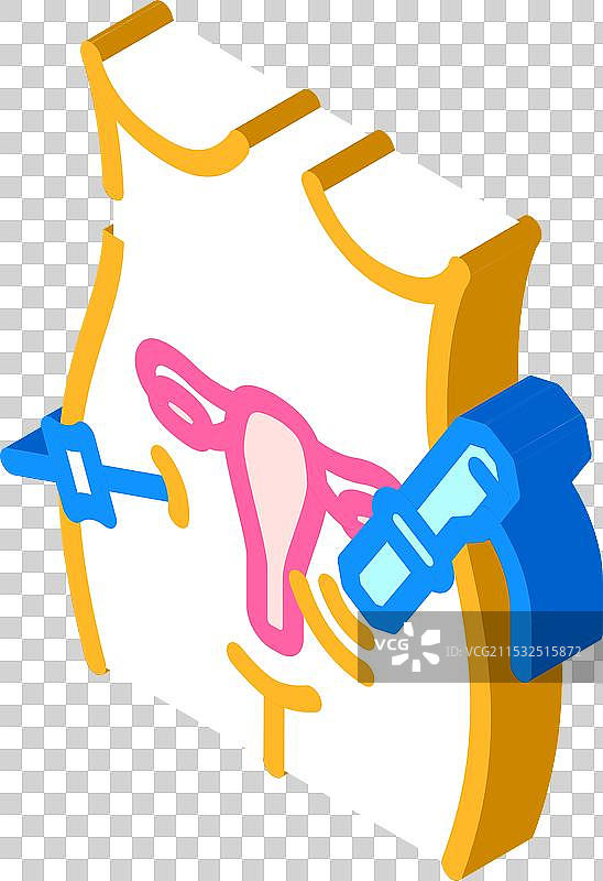 妇科腹腔镜手术等距图标图片素材