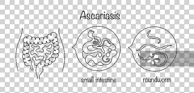 蛲虫病图片素材