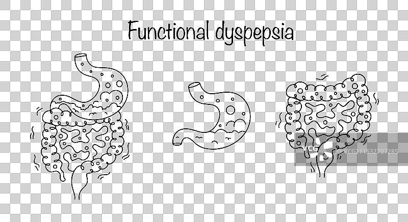 功能性消化不良图片素材