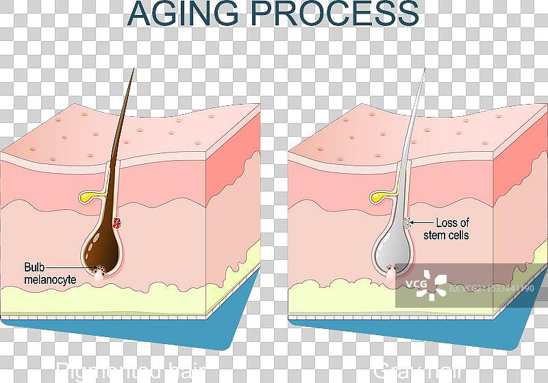 衰老过程中的白发图片素材