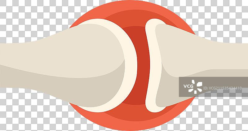 人类关节炎引起的疼痛图片素材