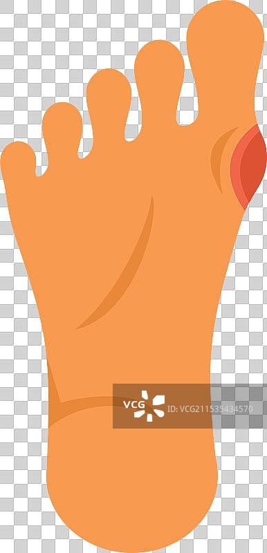 人类脚部出现疼痛的拇外翻图片素材