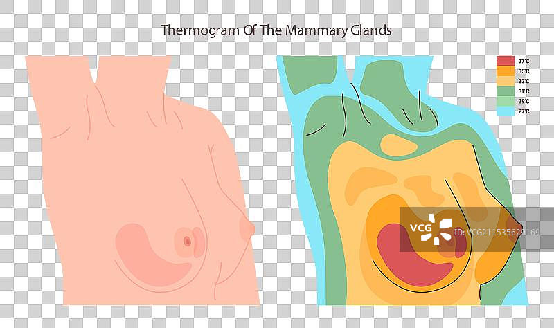 女性胸部的热成像图图片素材