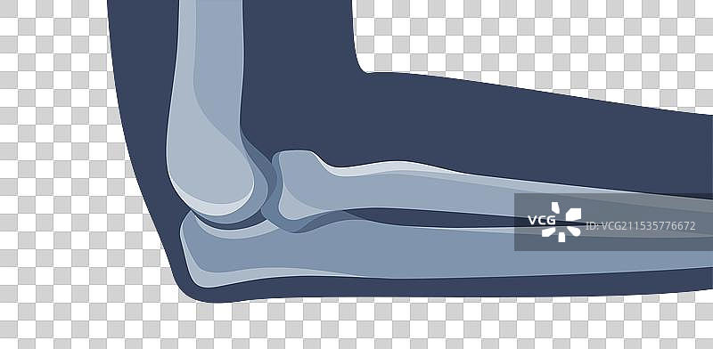 人类肘部X光影像用于医学诊断图片素材