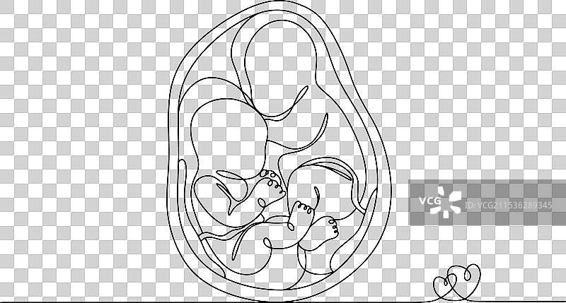 双胞胎妊娠，异卵双胞胎图片素材