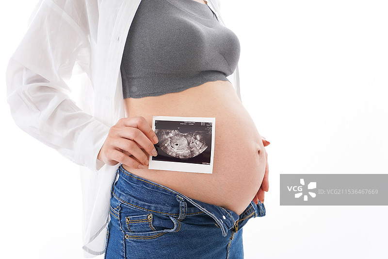 年轻孕妇与超声图像图片素材