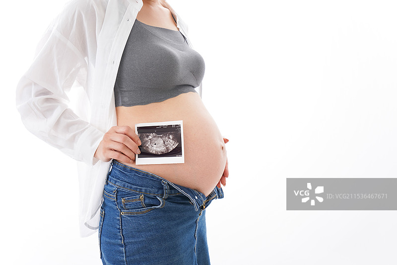 年轻的孕妇与超声图像图片素材