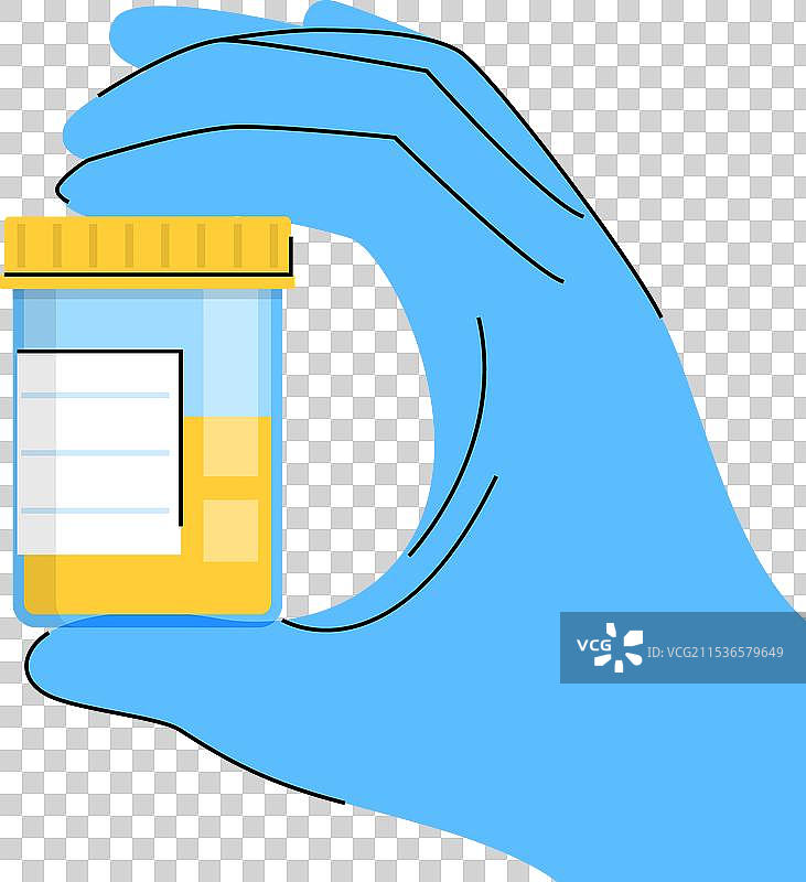 手握尿液样本容器图片素材