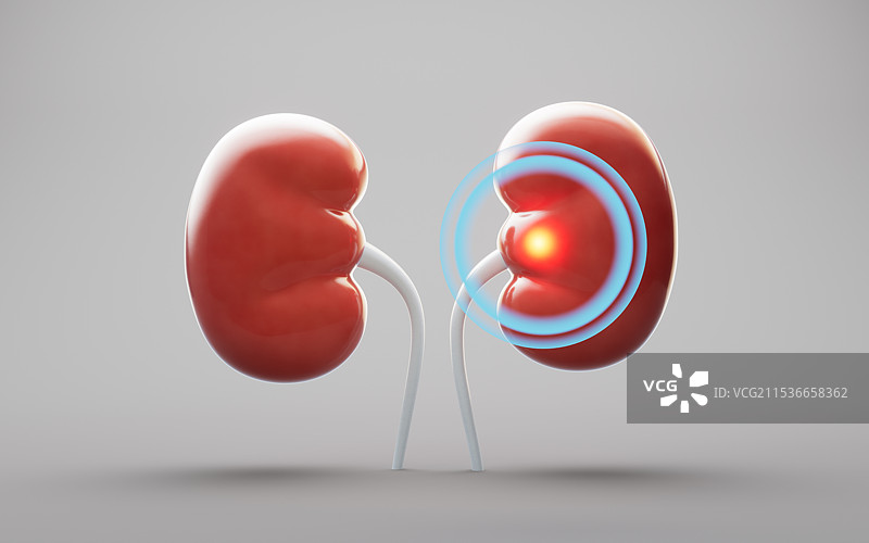 肾脏器官疾病医疗概念三维渲染图片素材