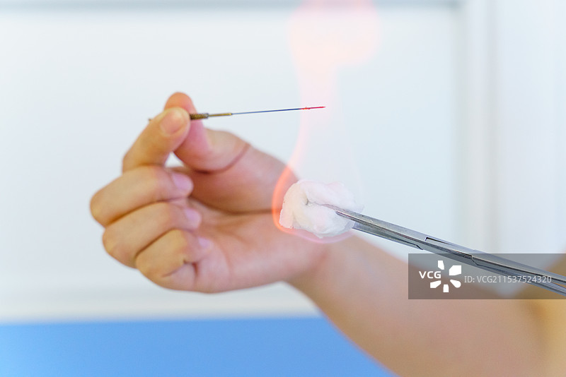 中医 火针灸疗法的特写图片素材