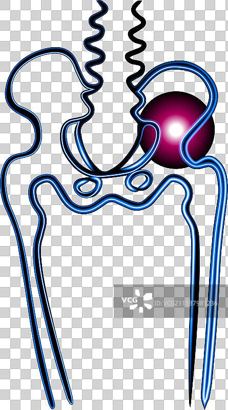 骨盆骨伤 骨盆骨折图片素材