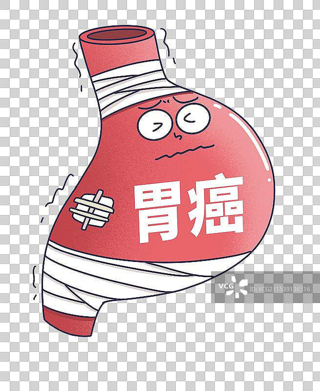 胃癌，胃部癌症图片素材