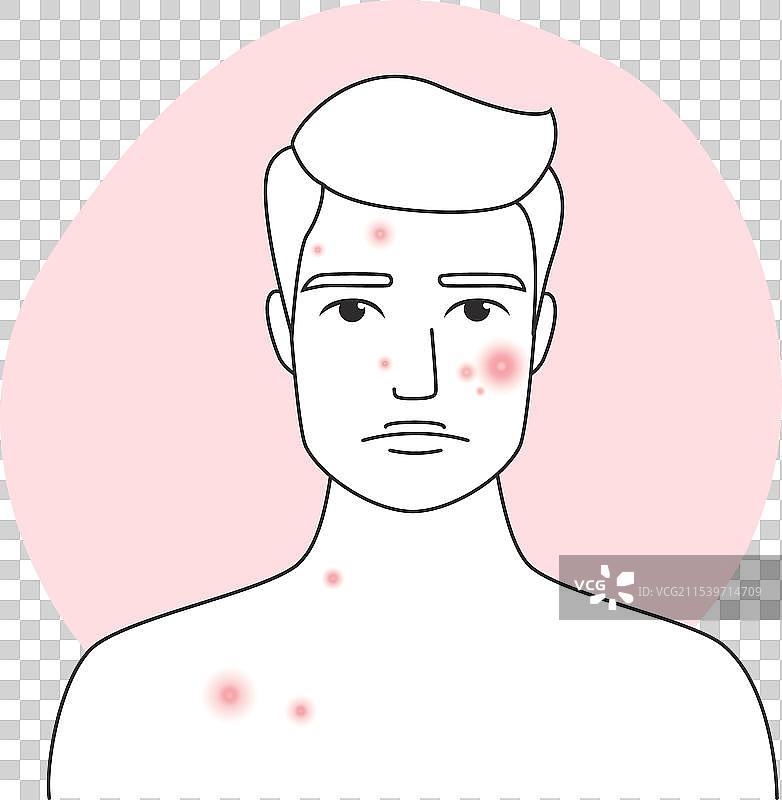 面部皮肤有痤疮和皮炎的伤心男人图片素材